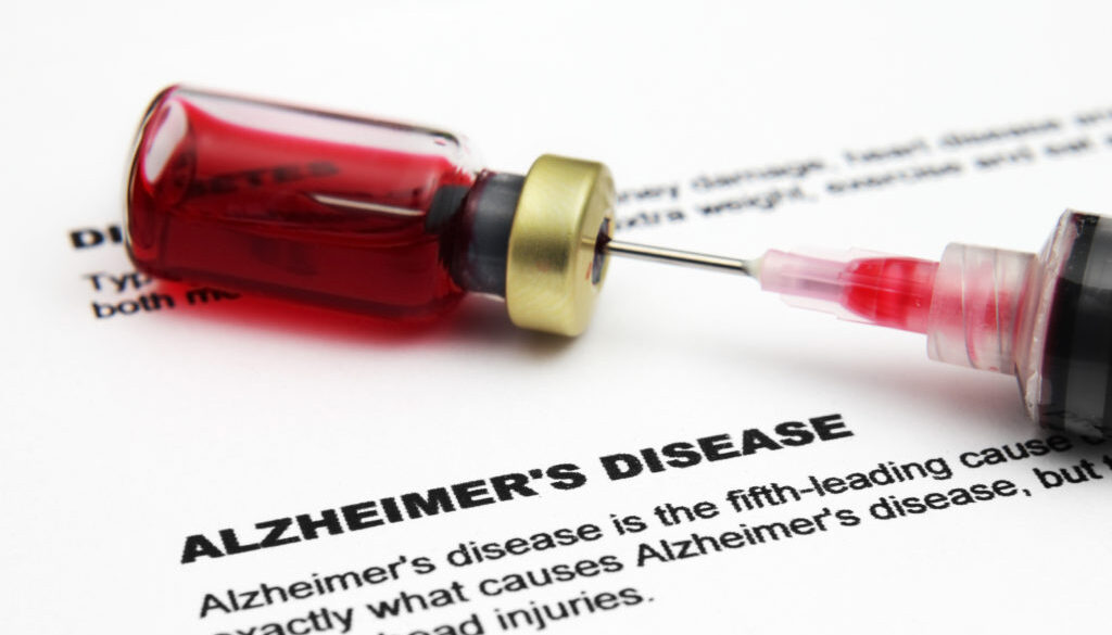 Alzheimer disease