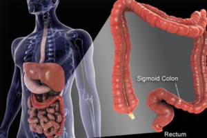 healthy-colon